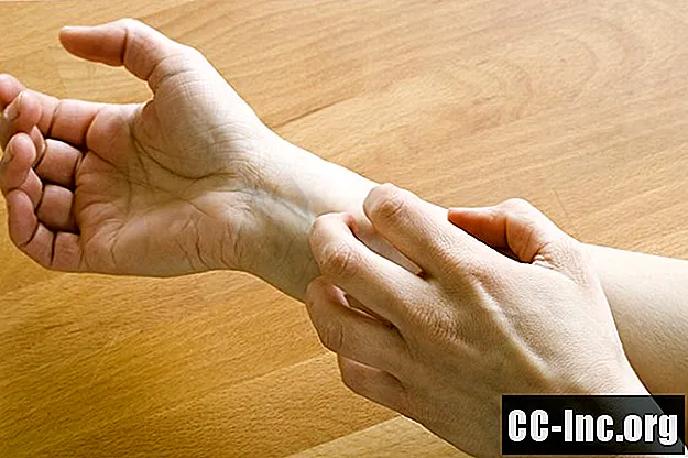 O prezentare generală a eczemei ​​mâinilor