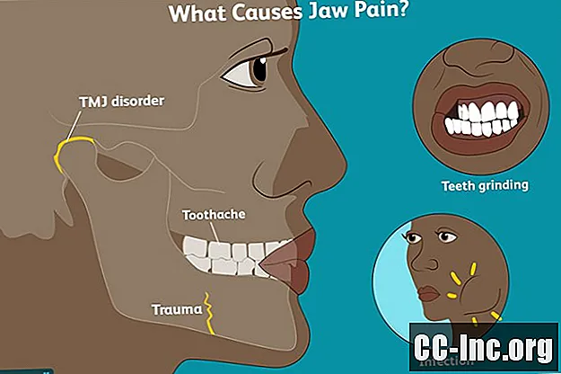 Una descripción general del dolor de mandíbula