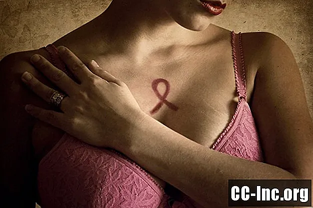 Uma visão geral do câncer de mama metaplásico - Medicamento
