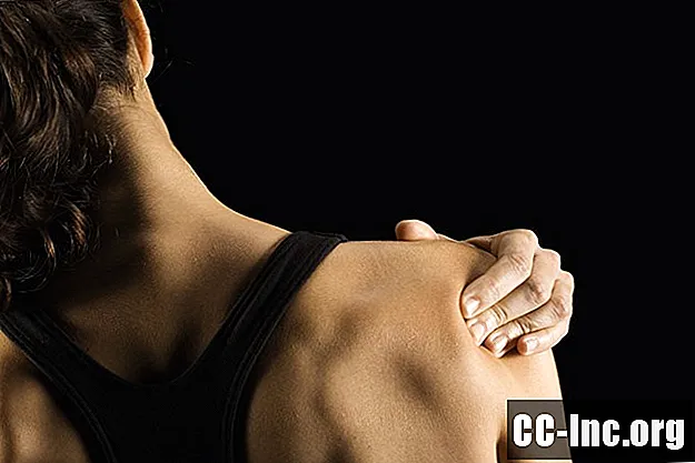 筋肉痛の概要