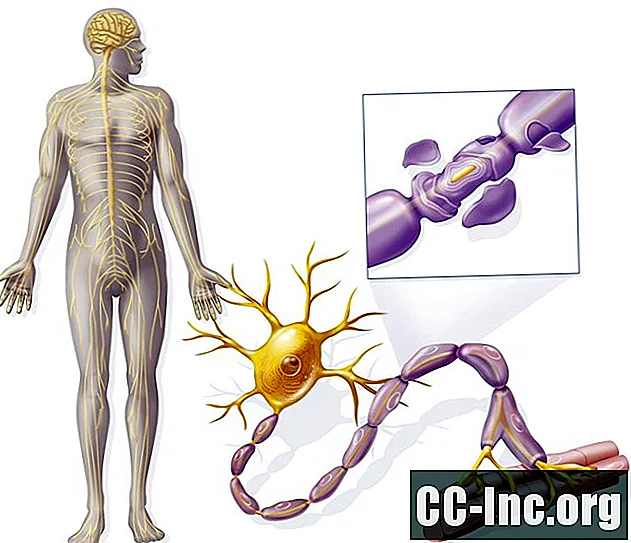 न्यूरोमाइलाइटिस ऑप्टिका स्पेक्ट्रम विकार का अवलोकन