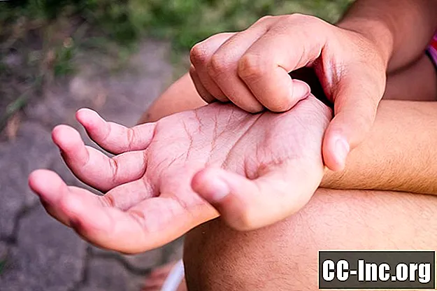A kéz és láb pikkelysömörének áttekintése - Gyógyszer