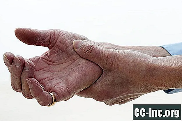 Uma visão geral dos gatilhos da artrite psoriática