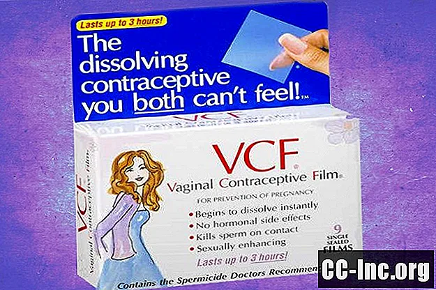 Maksts kontracepcijas plēves (VCF) pārskats