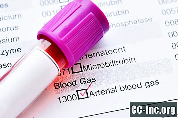 Pruebas y resultados de gasometría arterial (ABG)