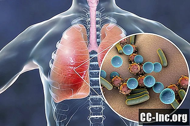 דלקת ריאות חיידקית אצל אנשים עם COPD