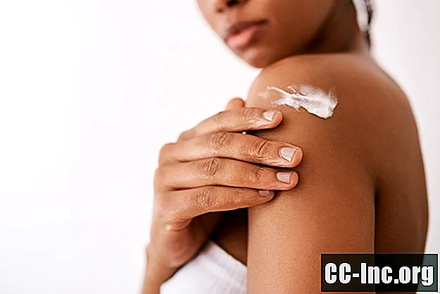 Najboljši tretmaji za okužbo kože Tinea Versicolor - Zdravilo