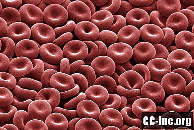 Понимание количества красных кровяных телец (эритроцитов)