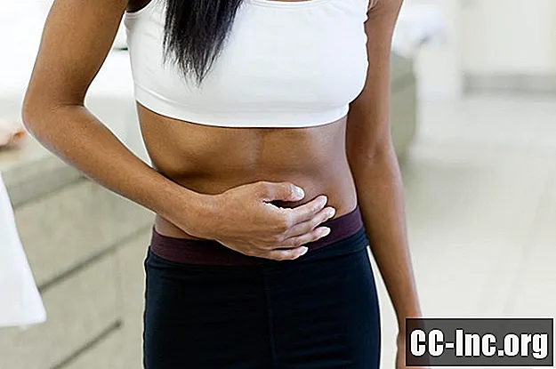 Nở và căng trong IBS