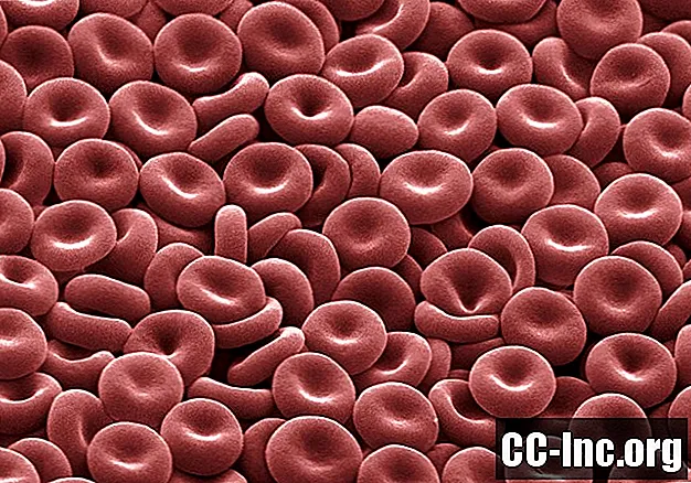 Cáncer de sangre y anemia