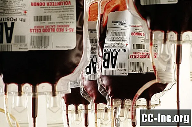 Blutgruppen und Kompatibilität für Spenden