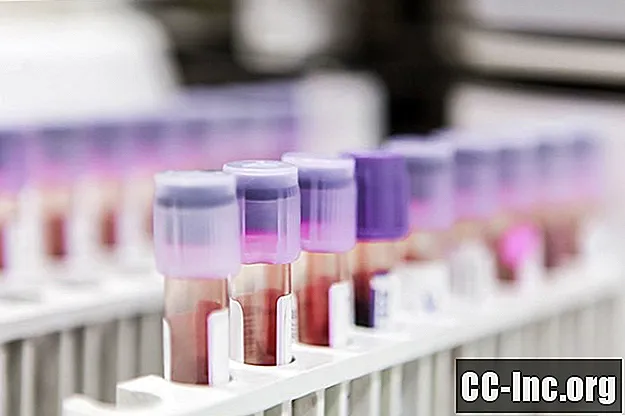 Teste de marker al tumorii cancerului de sân - Medicament
