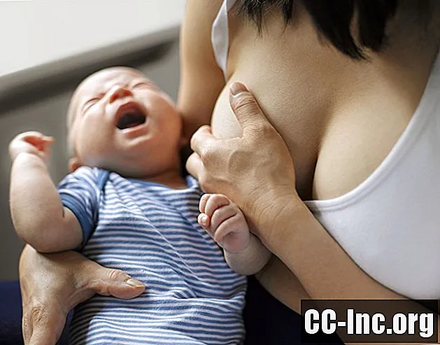 母乳育児とウイルス性肝炎