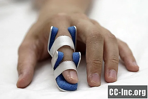 Causas comunes de lesiones en los dedos