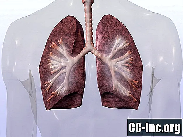 COPD 병태 생리학 및 폐의 작동 원리