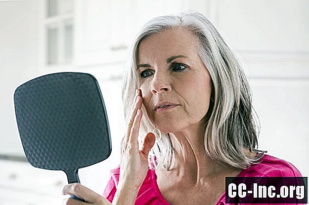 Kalcio nuosėdos ant veido simptomai ir priežastys