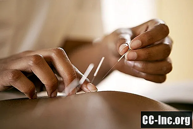 Kann Akupunktur den Blutdruck senken?