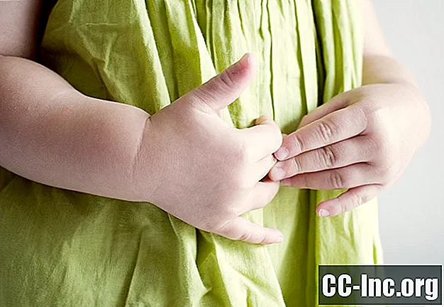 Могут ли дети заболеть остеоартрозом?