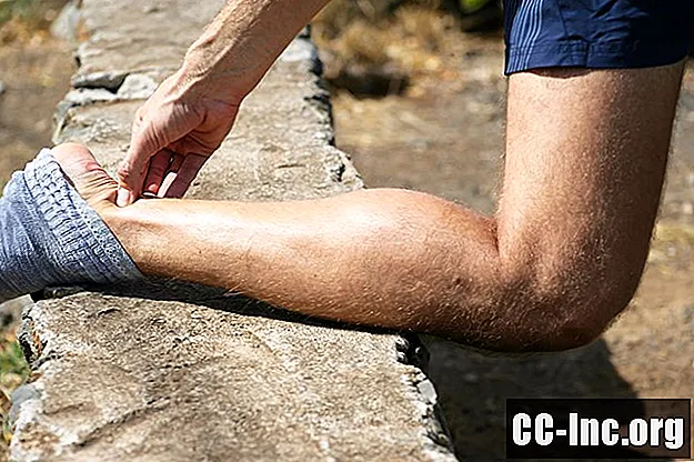 Kas kortisooni võtetega saab ravida Achilleuse kõõluse vigastusi?