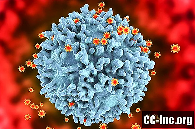 Može li udarivanje povećati rizik od HIV-a?