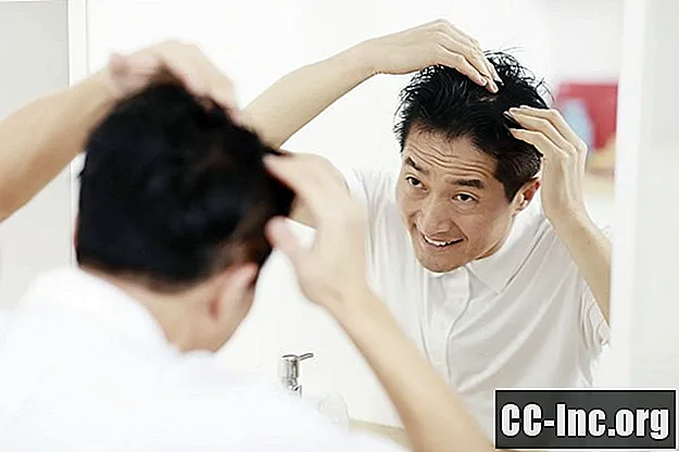 Können Nahrungsmittelallergien Haarausfall verursachen?