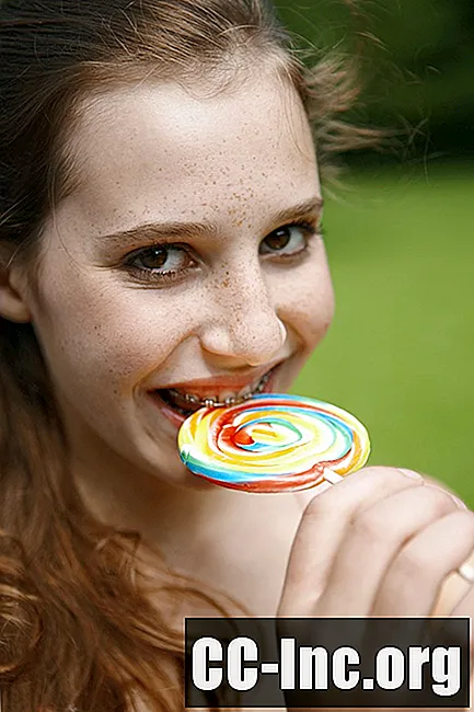 Kann ich Süßigkeiten mit Zahnspangen essen?