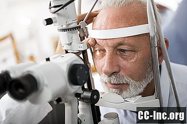 Može li prednizon izazvati kataraktu?