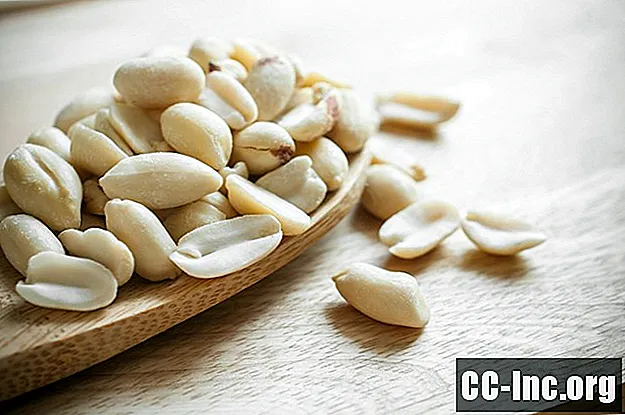 ¿Oler cacahuetes puede causar una reacción alérgica?