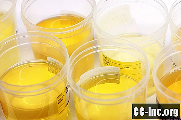 L'urina può davvero eliminare l'acne? - Medicinale