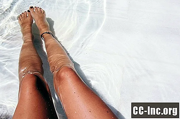 Nước có thể có hại cho da của bạn?