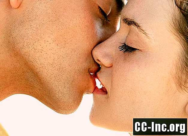 Können Sie HIV durch Küssen bekommen?