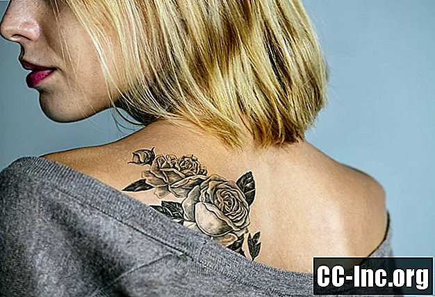 Μπορείτε να πάρετε τατουάζ εάν έχετε ψωρίαση;