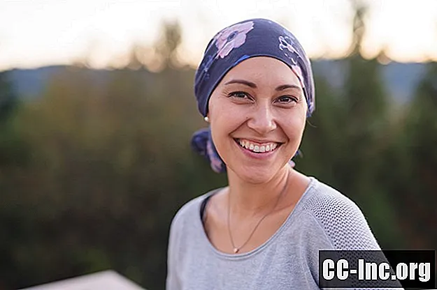 Czy możesz zapobiec wypadaniu włosów po chemioterapii?