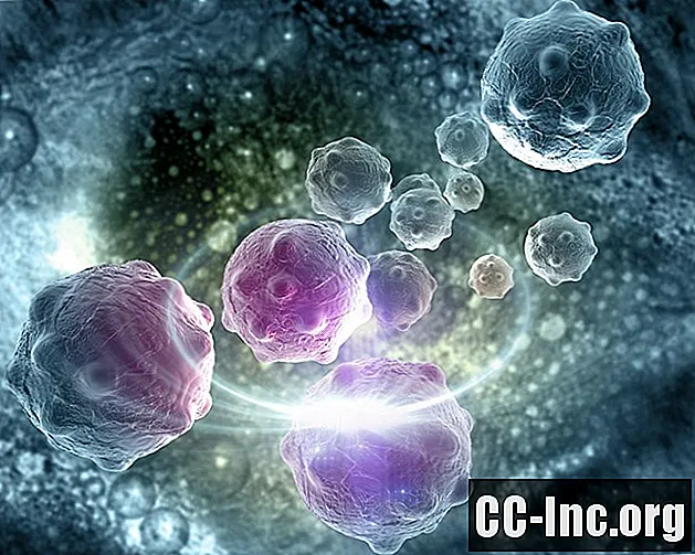 Vēža šūnas: kā tās sākas un raksturojums