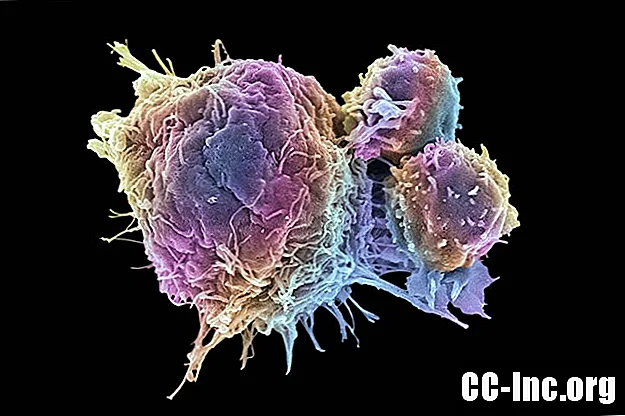 Células cancerosas versus células normales: ¿en qué se diferencian?