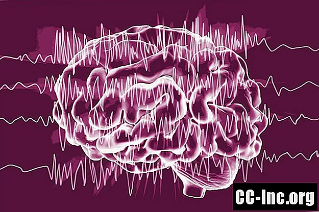 קנבידיול (CBD) לטיפול באפילפסיה