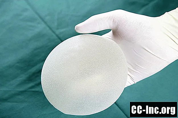 Contractura capsular e implantes mamarios
