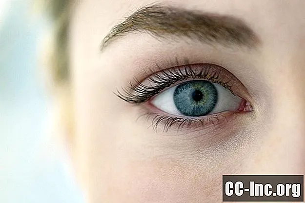 Симптоми и узроци синдрома мачјег ока