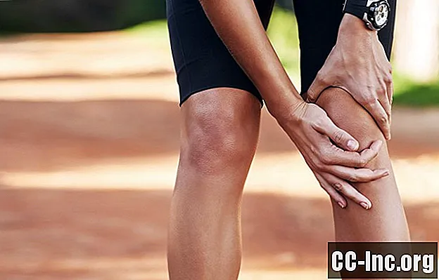 Причина за пукане или щракване на коляното