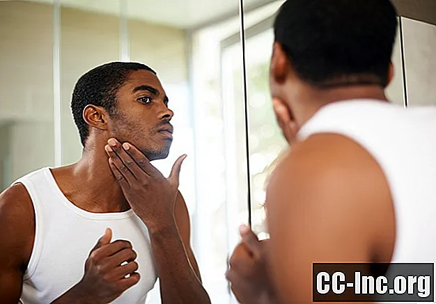Cause e fattori di rischio dell'acne