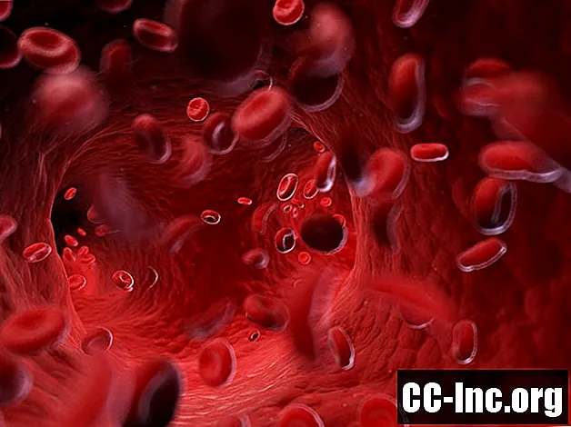 Cauze și factori de risc ai anemiei