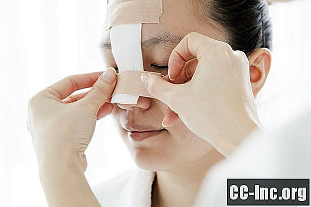 Ursachen und Behandlung des Kollapses der Nasenklappe