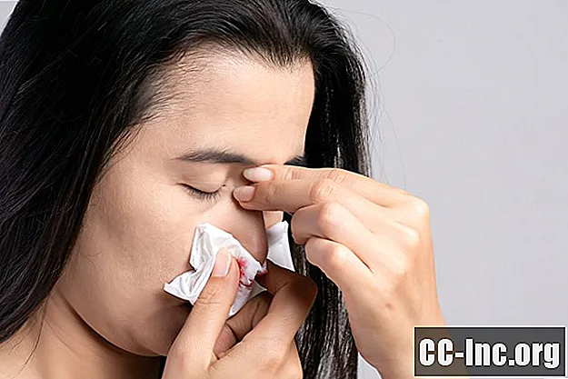 Årsaker og behandling av neseblod