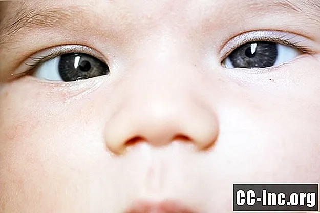 신생아의 교차 눈에 대한 원인 및 치료