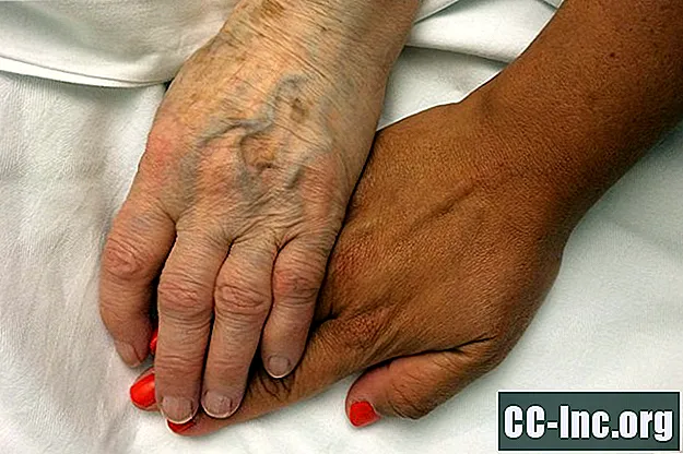 Uzroci smrti osoba oboljelih od Alzheimerove bolesti