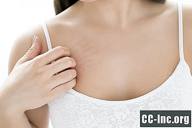 Orsaker till kliande bröst