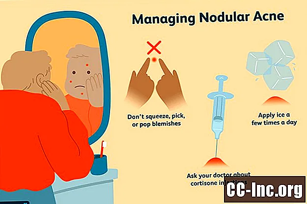 Oorzaken van nodulaire acne en hoe deze te behandelen