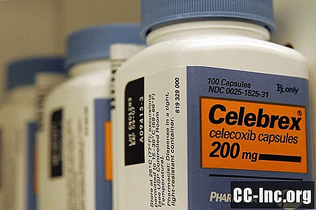 Celebrex (Celecoxib) 관절염 약물