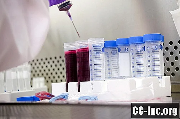 כימיה 7: בדיקות כימיה בדם