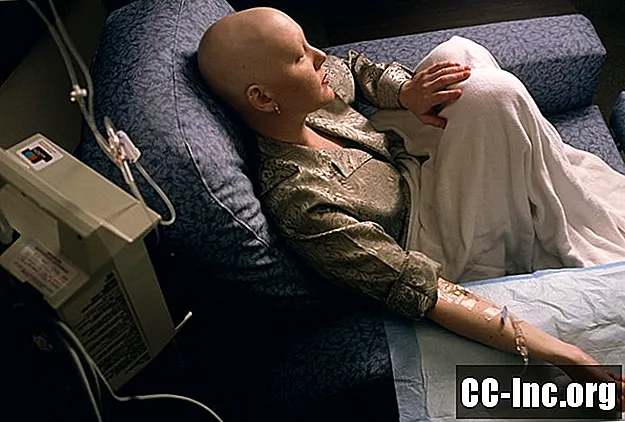 Chemioterapia raka płuc